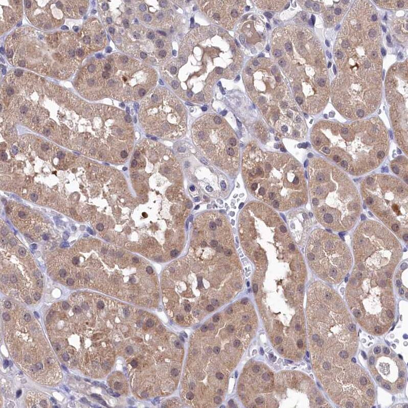 Ribonuclease Inhibitor Antibody - BSA Free Immunohistochemistry-Paraffin: Ribonuclease Inhibitor Antibody [NBP1-87161]