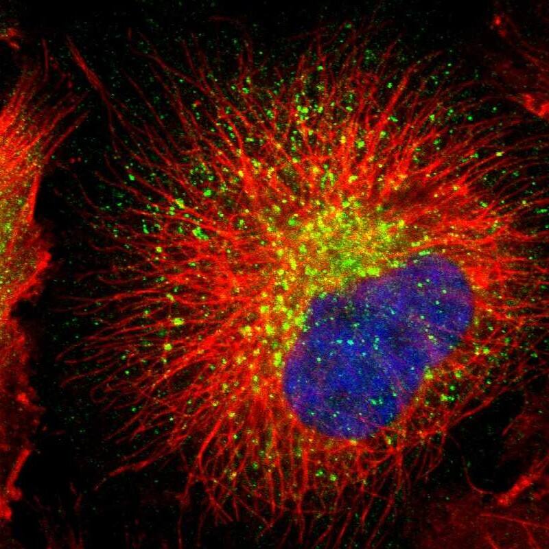 Rab7a Antibody - BSA Free Immunocytochemistry/ Immunofluorescence: Rab7a Antibody [NBP1-87174]