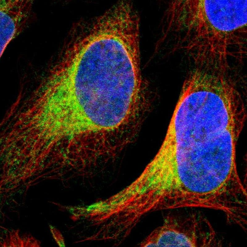 PTP1B/PTPN1 Antibody - BSA Free Immunocytochemistry/ Immunofluorescence: PTP1B/PTPN1 Antibody [NBP1-87191]