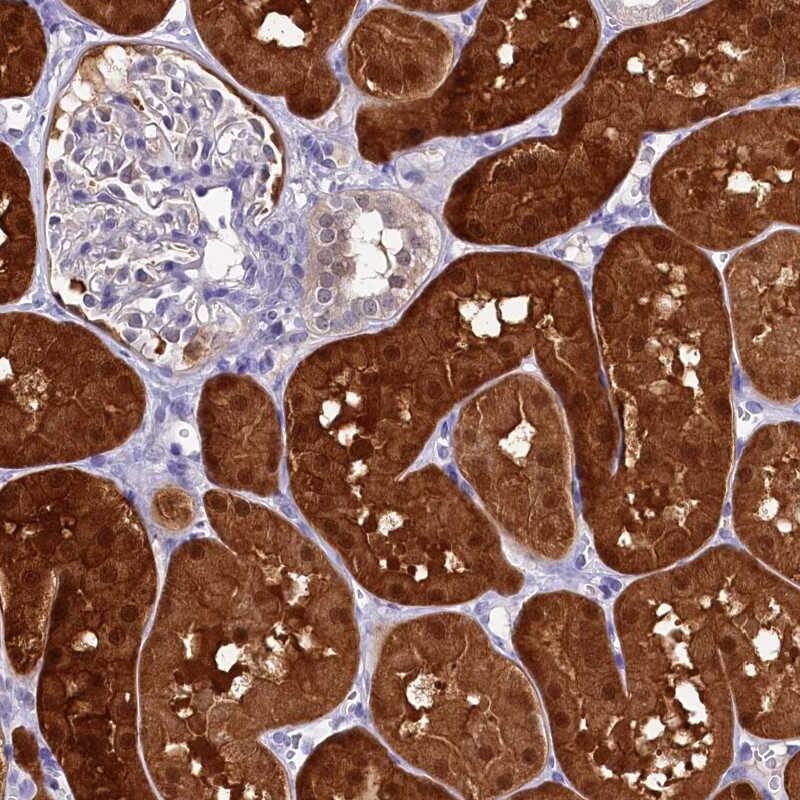 C11orf54 Antibody - BSA Free Immunohistochemistry-Paraffin: C11orf54 Antibody [NBP1-87194]