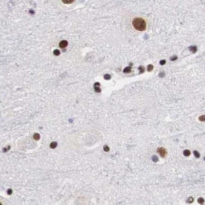 SF3A1 Antibody - BSA Free Immunohistochemistry-Paraffin: SF3A1 Antibody [NBP1-87214]