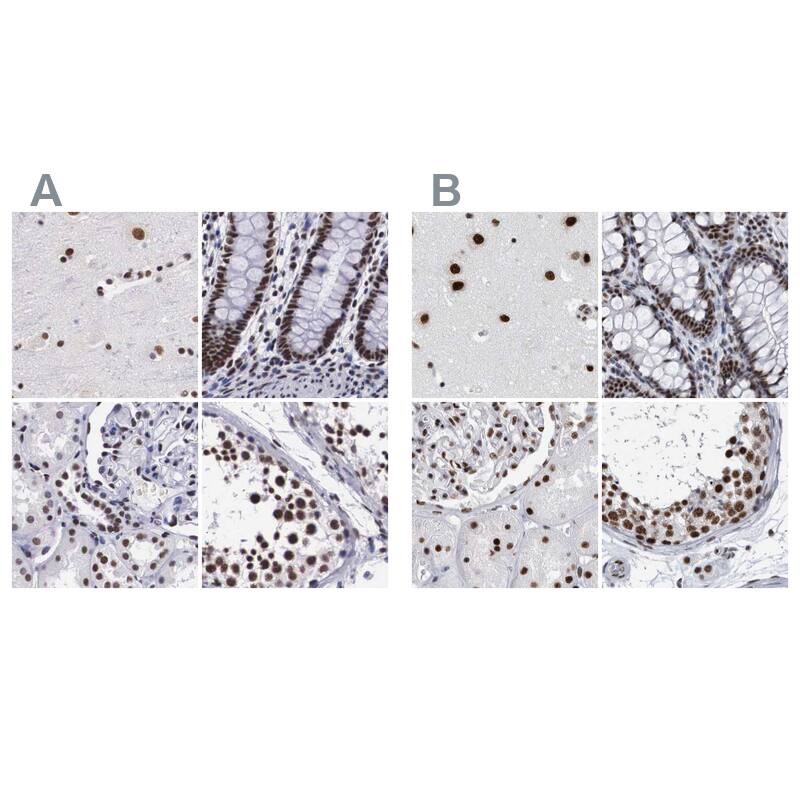 SF3A1 Antibody - BSA Free Immunohistochemistry-Paraffin: SF3A1 Antibody [NBP1-87214]