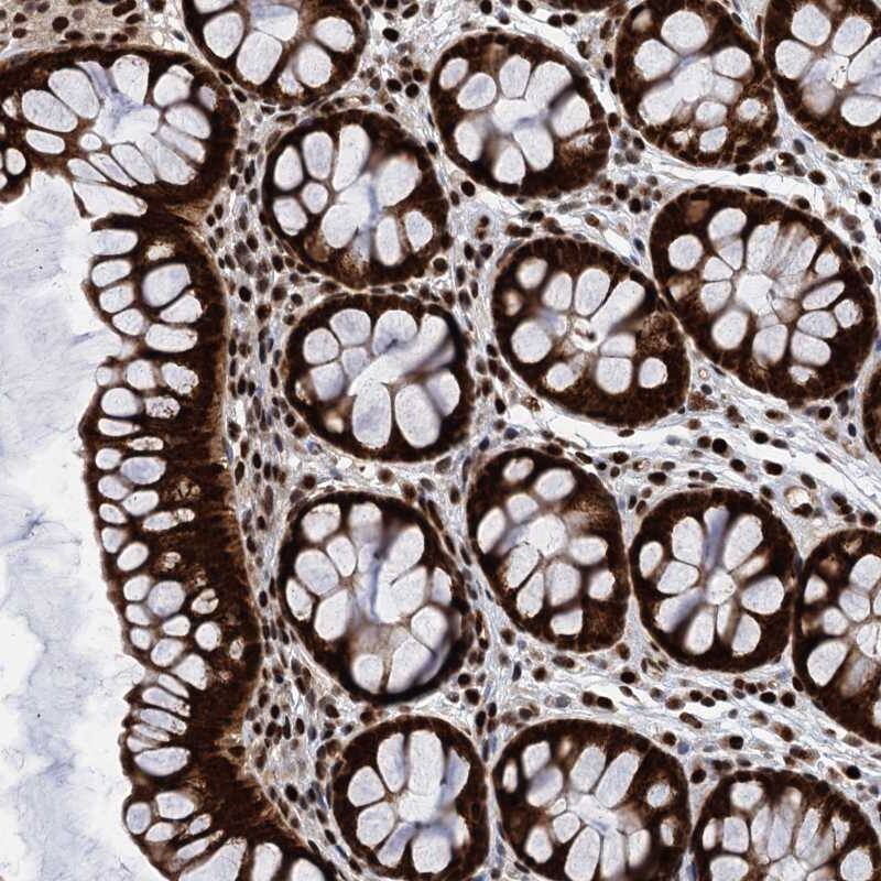 PPP4R1 Antibody - BSA Free Immunohistochemistry-Paraffin: PPP4R1 Antibody [NBP1-87242]