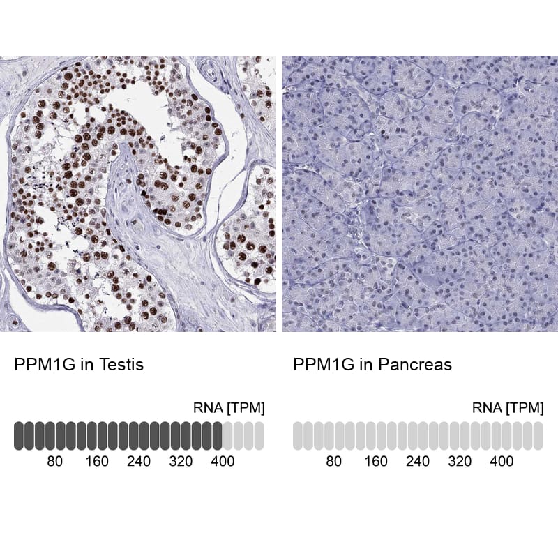 PP2C gamma/PPM1G Antibody - BSA Free Immunohistochemistry-Paraffin: PP2C gamma/PPM1G Antibody [NBP1-87246]