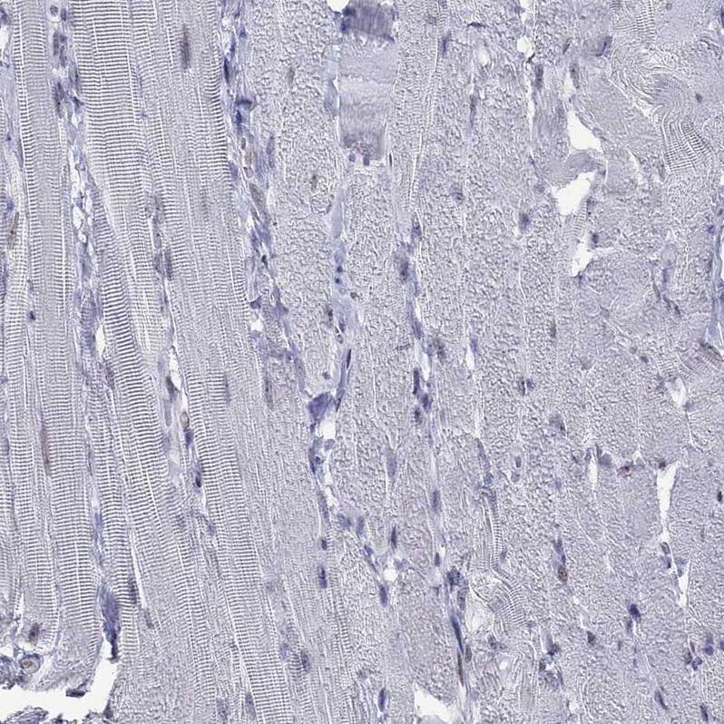 PP2C gamma/PPM1G Antibody - BSA Free Immunohistochemistry-Paraffin: PP2C gamma/PPM1G Antibody [NBP1-87246]