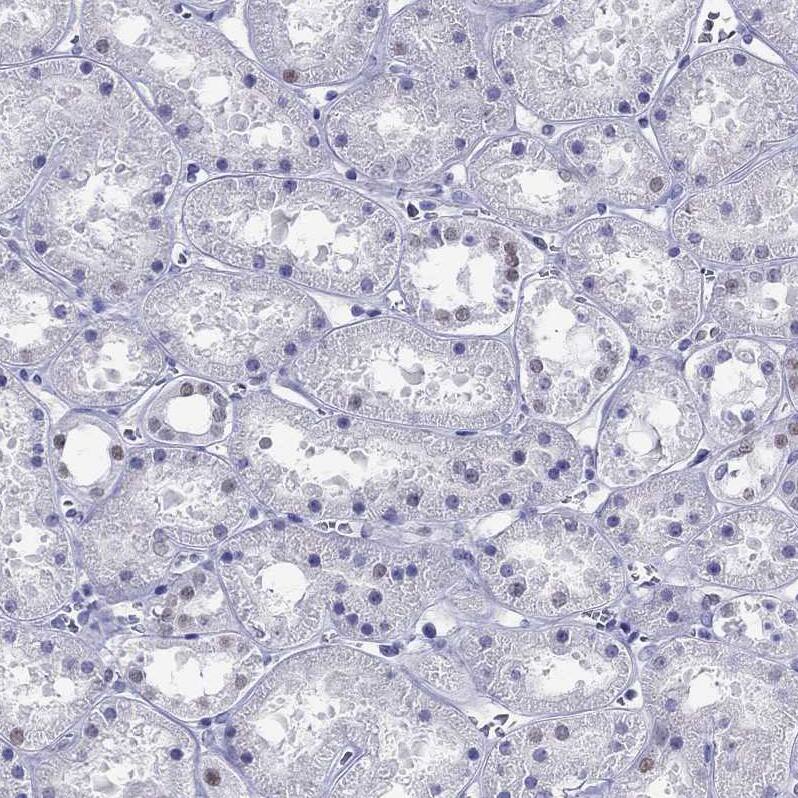 PP2C gamma/PPM1G Antibody - BSA Free Immunohistochemistry-Paraffin: PP2C gamma/PPM1G Antibody [NBP1-87246]