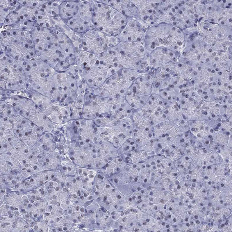 PP2C gamma/PPM1G Antibody - BSA Free Immunohistochemistry-Paraffin: PP2C gamma/PPM1G Antibody [NBP1-87246]