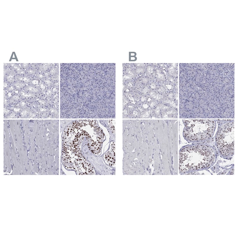 PP2C gamma/PPM1G Antibody - BSA Free Immunohistochemistry-Paraffin: PP2C gamma/PPM1G Antibody [NBP1-87246]