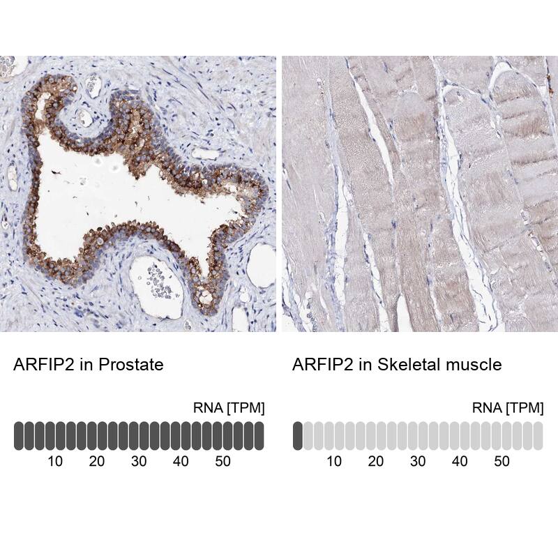 ARFIP2 Antibody - BSA Free Immunohistochemistry-Paraffin: ARFIP2 Antibody [NBP1-87255]