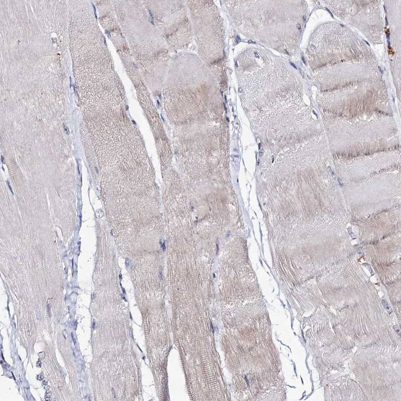 ARFIP2 Antibody - BSA Free Immunohistochemistry-Paraffin: ARFIP2 Antibody [NBP1-87255]