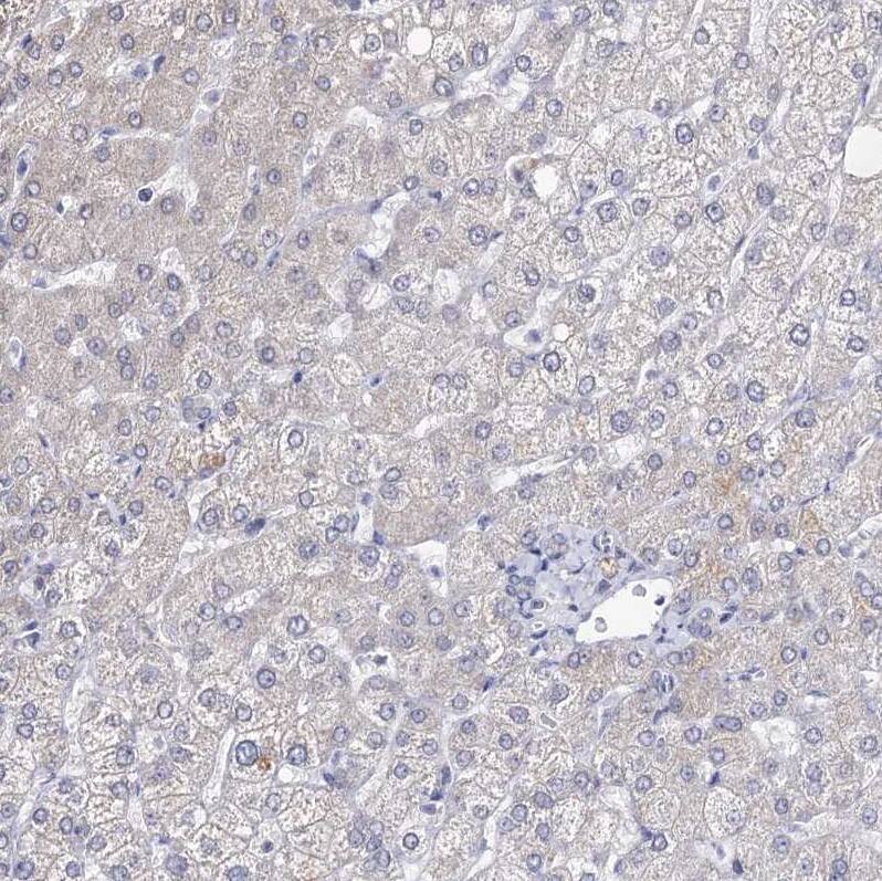 ARFIP2 Antibody - BSA Free Immunohistochemistry-Paraffin: ARFIP2 Antibody [NBP1-87255]