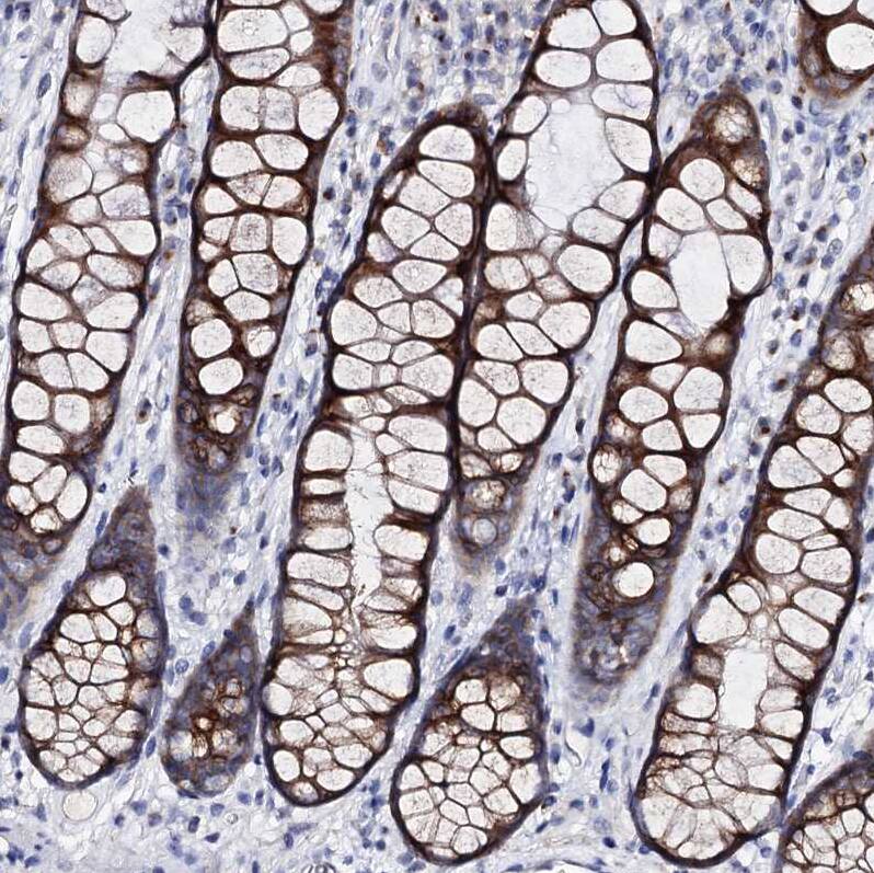 ARFIP2 Antibody - BSA Free Immunohistochemistry-Paraffin: ARFIP2 Antibody [NBP1-87255]