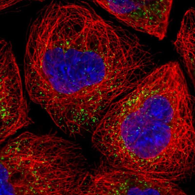 PMP70 Antibody - BSA Free Immunocytochemistry/ Immunofluorescence: PMP70 Antibody [NBP1-87258]