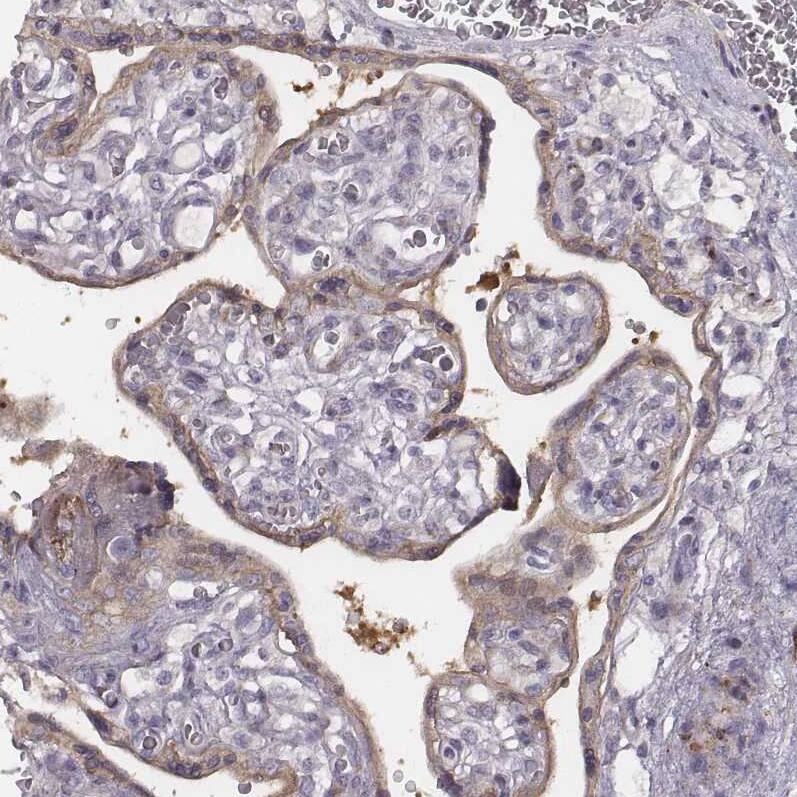 PKC zeta Antibody - BSA Free Immunohistochemistry-Paraffin: PKC zeta Antibody [NBP1-87270]