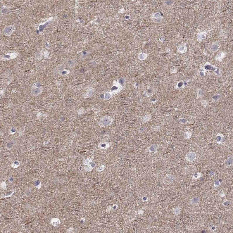 PKC zeta Antibody - BSA Free Immunohistochemistry-Paraffin: PKC zeta Antibody [NBP1-87270]