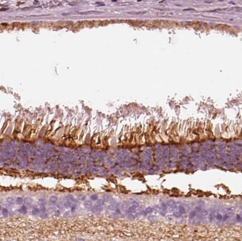 PKC zeta Antibody - BSA Free Immunohistochemistry-Paraffin: PKC zeta Antibody [NBP1-87270]