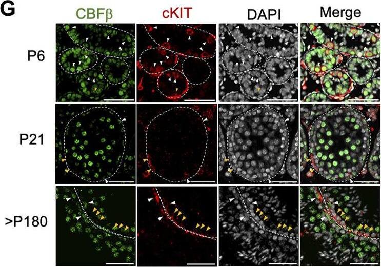 CBFB Antibody - BSA Free