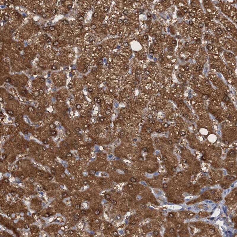 PNPO Antibody - BSA Free Immunohistochemistry-Paraffin: PNPO Antibody [NBP1-87303]