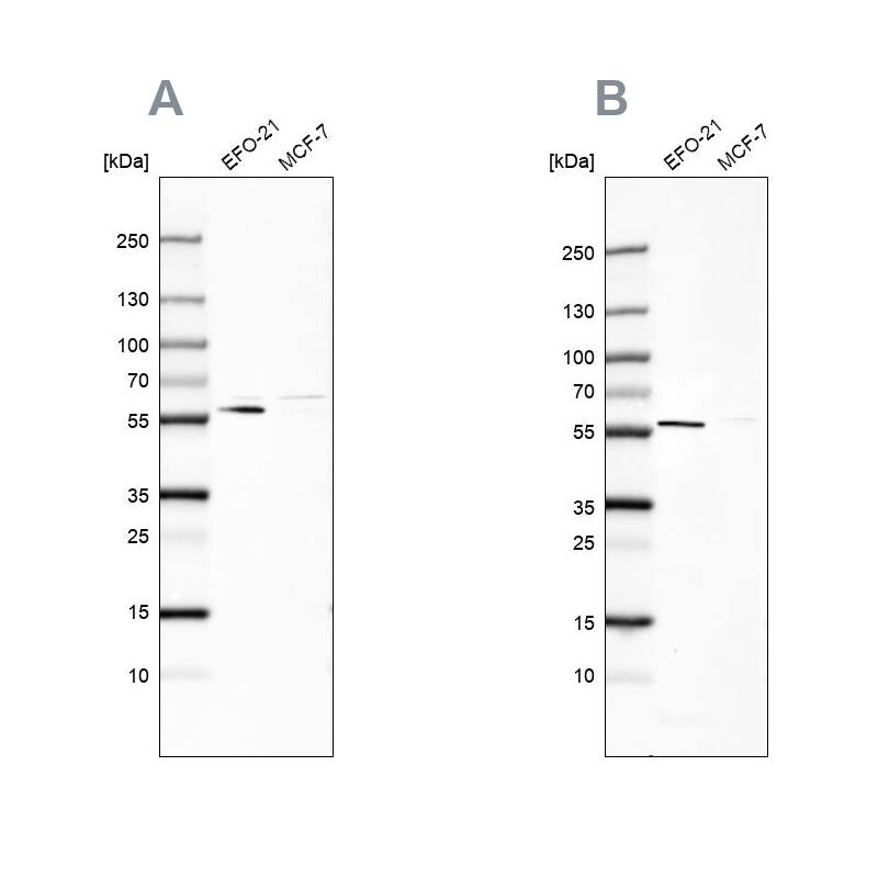 Pyruvate Dehydrogenase Phosphatase/PDP1/PPM2C Antibody Western Blot: Pyruvate Dehydrogenase Phosphatase/PDP1/PPM2C Antibody Antibody [NBP1-87308]