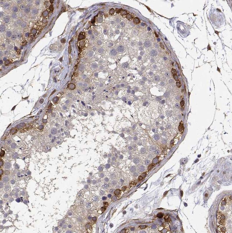 PHGDH Antibody - BSA Free Immunohistochemistry-Paraffin: PHGDH Antibody [NBP1-87310]