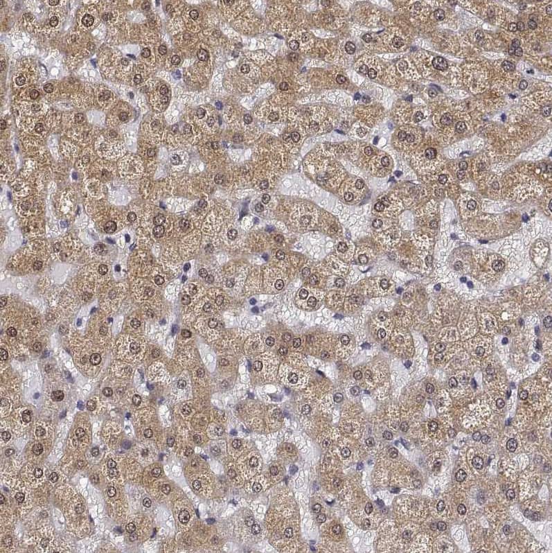 PHGDH Antibody - BSA Free Immunohistochemistry-Paraffin: PHGDH Antibody [NBP1-87310]