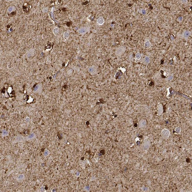 PHGDH Antibody - BSA Free Immunohistochemistry-Paraffin: PHGDH Antibody [NBP1-87310]