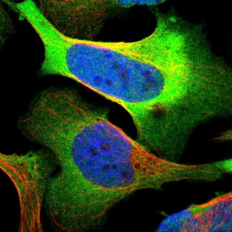 PHGDH Antibody - BSA Free Immunocytochemistry/ Immunofluorescence: PHGDH Antibody [NBP1-87311]