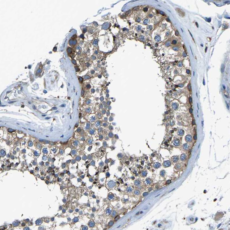 PCTAIRE2 Antibody - BSA Free Immunohistochemistry-Paraffin: PCTAIRE2 Antibody [NBP1-87316]