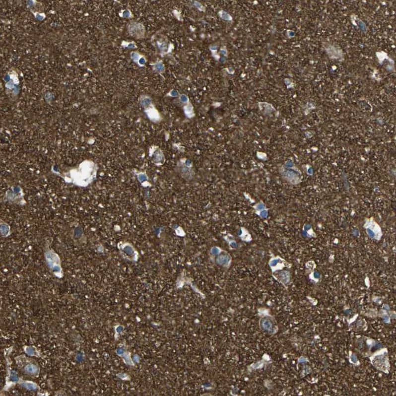PCTAIRE2 Antibody - BSA Free Immunohistochemistry-Paraffin: PCTAIRE2 Antibody [NBP1-87316]