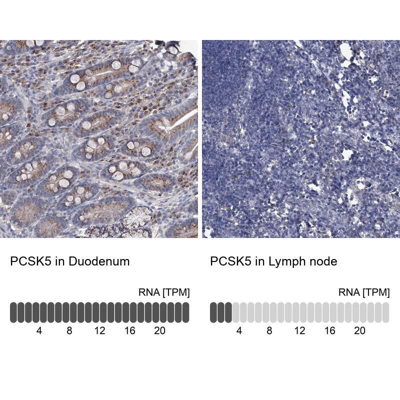 PC6 Antibody - BSA Free Immunohistochemistry-Paraffin: PC6 Antibody [NBP1-87326]