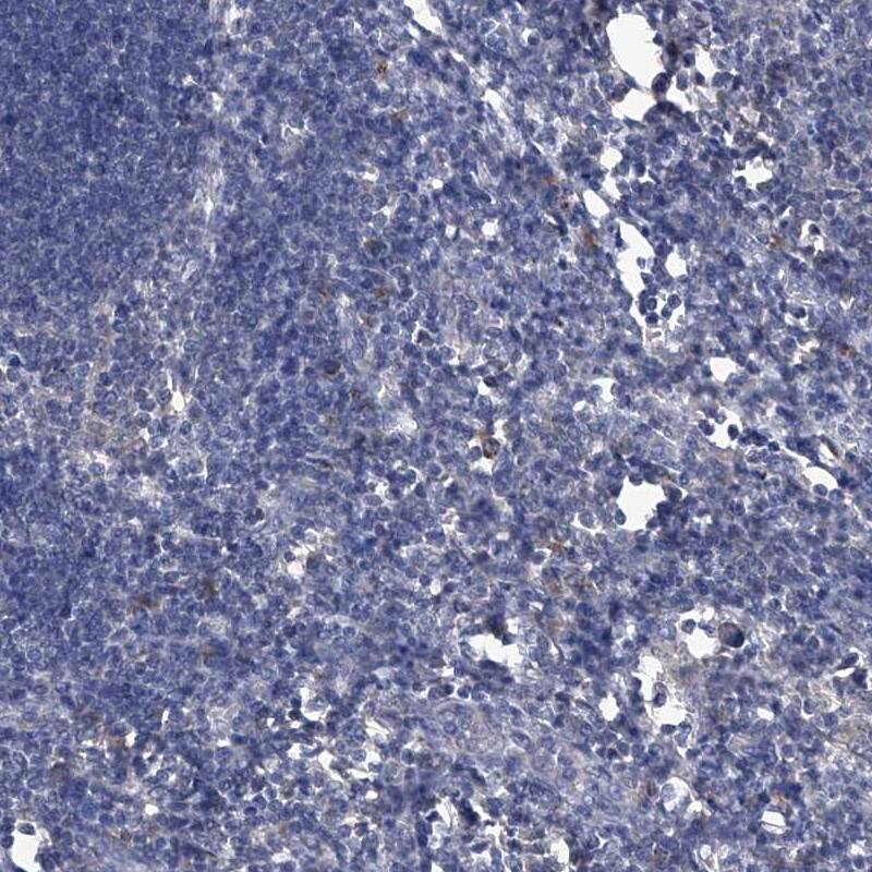 PC6 Antibody - BSA Free Immunohistochemistry-Paraffin: PC6 Antibody [NBP1-87326]