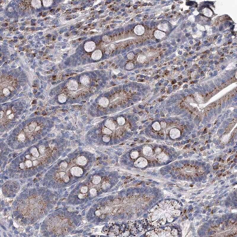 PC6 Antibody - BSA Free Immunohistochemistry-Paraffin: PC6 Antibody [NBP1-87326]