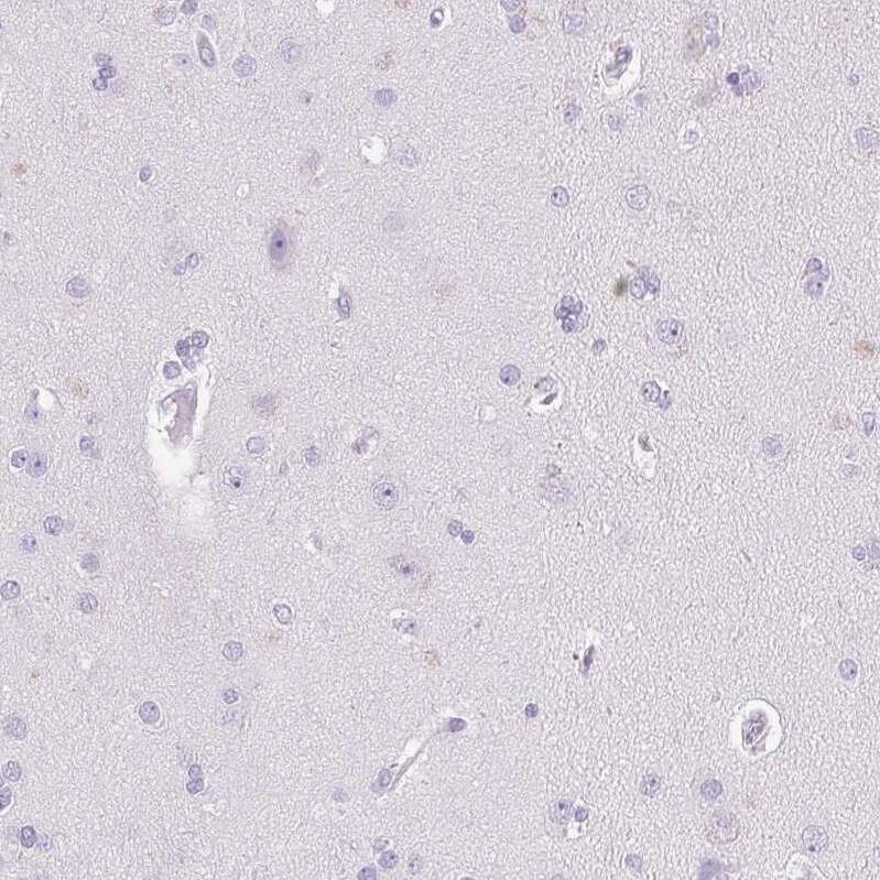 Pappalysin-2/PAPP-A2 Antibody - BSA Free Immunohistochemistry-Paraffin: Pappalysin-2/PAPP-A2 Antibody [NBP1-87339]