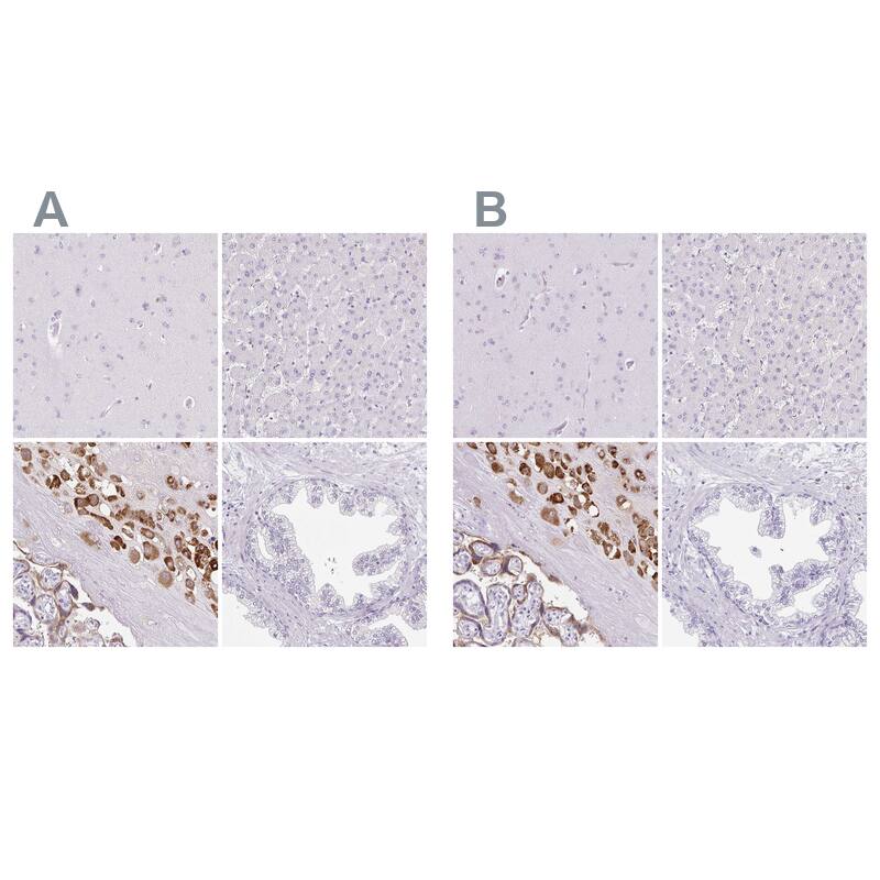 Pappalysin-2/PAPP-A2 Antibody - BSA Free Immunohistochemistry-Paraffin: Pappalysin-2/PAPP-A2 Antibody [NBP1-87339]