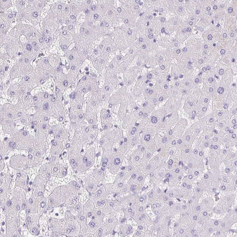 Pappalysin-2/PAPP-A2 Antibody - BSA Free Immunohistochemistry-Paraffin: Pappalysin-2/PAPP-A2 Antibody [NBP1-87339]