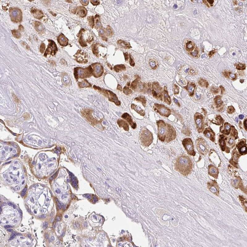 Pappalysin-2/PAPP-A2 Antibody - BSA Free Immunohistochemistry-Paraffin: Pappalysin-2/PAPP-A2 Antibody [NBP1-87339]