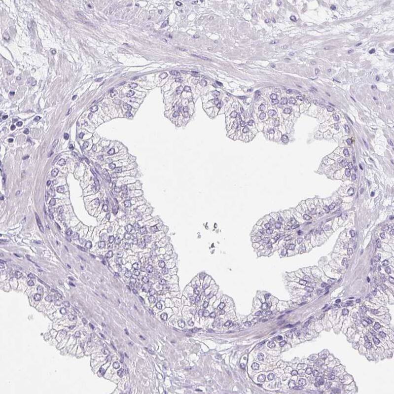 Pappalysin-2/PAPP-A2 Antibody - BSA Free Immunohistochemistry-Paraffin: Pappalysin-2/PAPP-A2 Antibody [NBP1-87339]