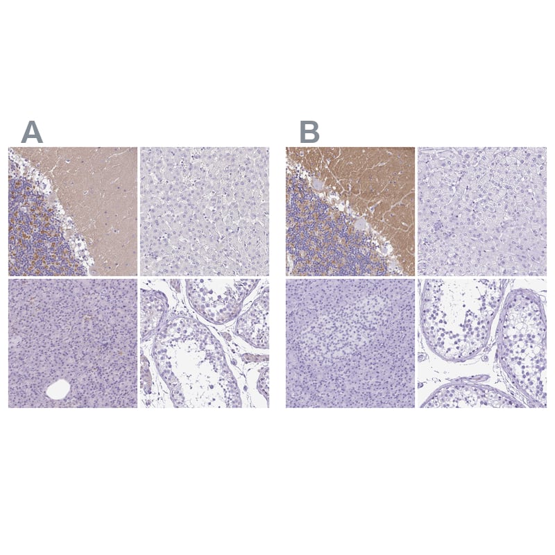 Synaptotagmin 1 Antibody Immunohistochemistry-Paraffin: Synaptotagmin 1 Antibody Antibody [NBP1-87362]