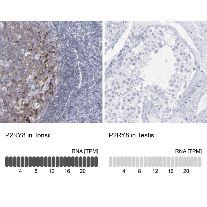 P2Y8 Antibody - BSA Free Immunohistochemistry-Paraffin: P2Y8 Antibody [NBP1-87375]