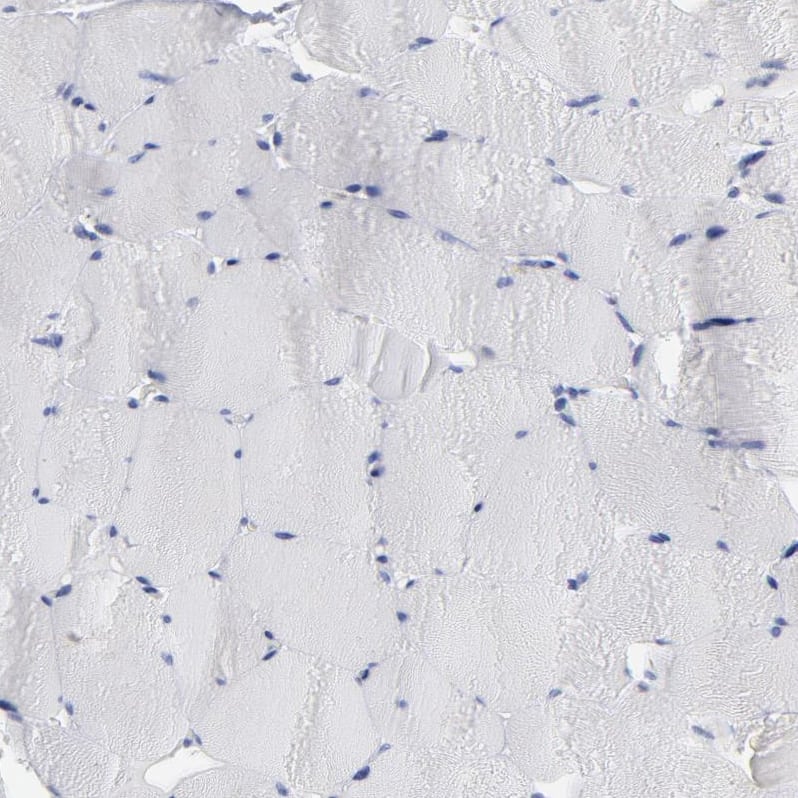 P2Y8 Antibody - BSA Free Immunohistochemistry-Paraffin: P2Y8 Antibody [NBP1-87375]