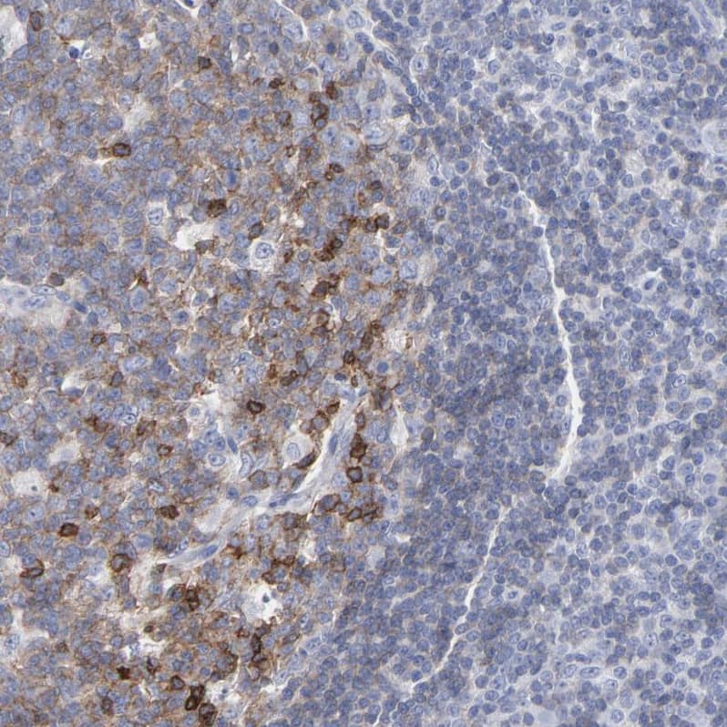 P2Y8 Antibody - BSA Free Immunohistochemistry-Paraffin: P2Y8 Antibody [NBP1-87375]