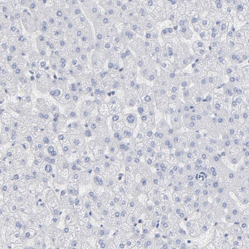 P2Y8 Antibody - BSA Free Immunohistochemistry-Paraffin: P2Y8 Antibody [NBP1-87375]