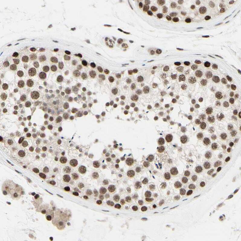 Suppressor of Fused Antibody - BSA Free Immunohistochemistry-Paraffin: Suppressor of Fused Antibody [NBP1-87384]
