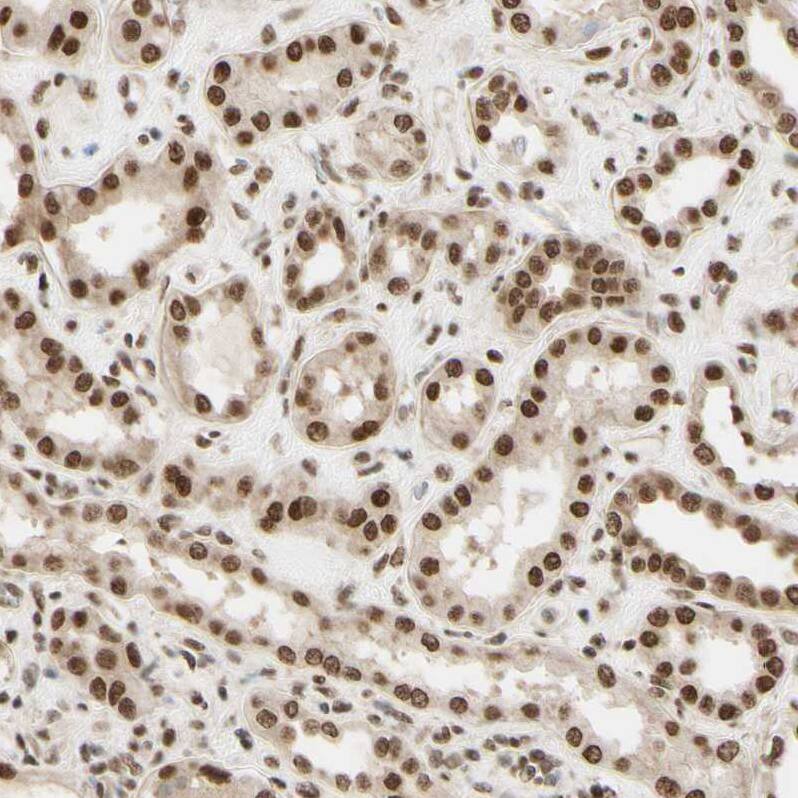 Suppressor of Fused Antibody - BSA Free Immunohistochemistry-Paraffin: Suppressor of Fused Antibody [NBP1-87384]