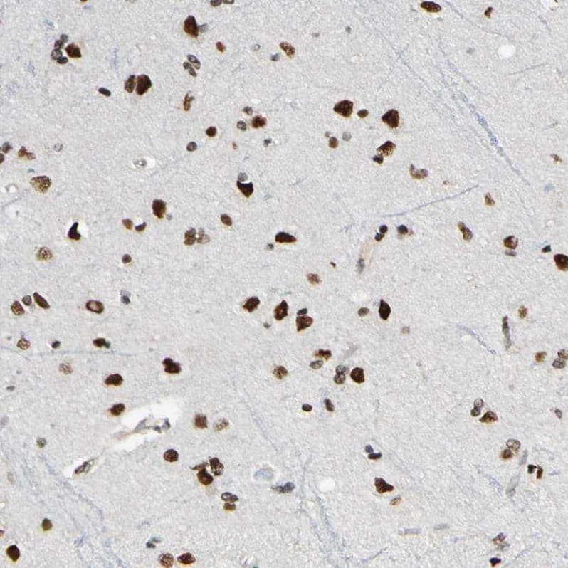 Suppressor of Fused Antibody - BSA Free Immunohistochemistry-Paraffin: Suppressor of Fused Antibody [NBP1-87384]