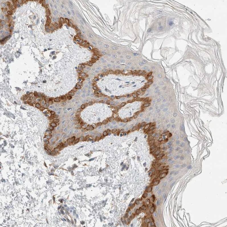 Delta 1 Tubulin Antibody - BSA Free Immunohistochemistry-Paraffin: Delta 1 Tubulin Antibody [NBP1-87391]