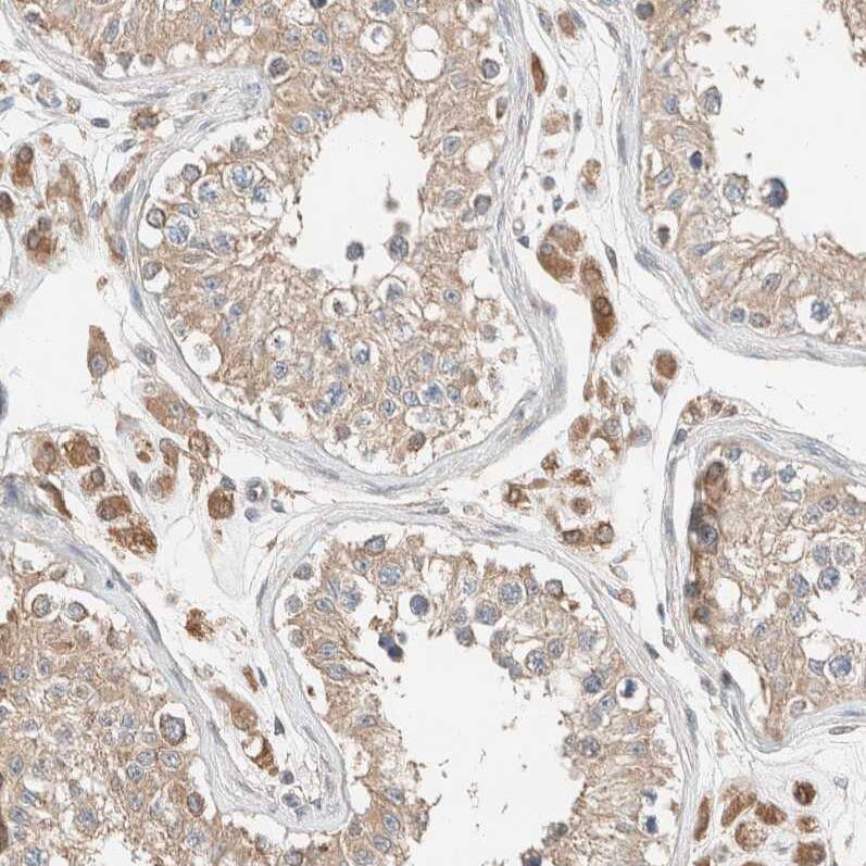 Delta 1 Tubulin Antibody - BSA Free Immunohistochemistry-Paraffin: Delta 1 Tubulin Antibody [NBP1-87391]