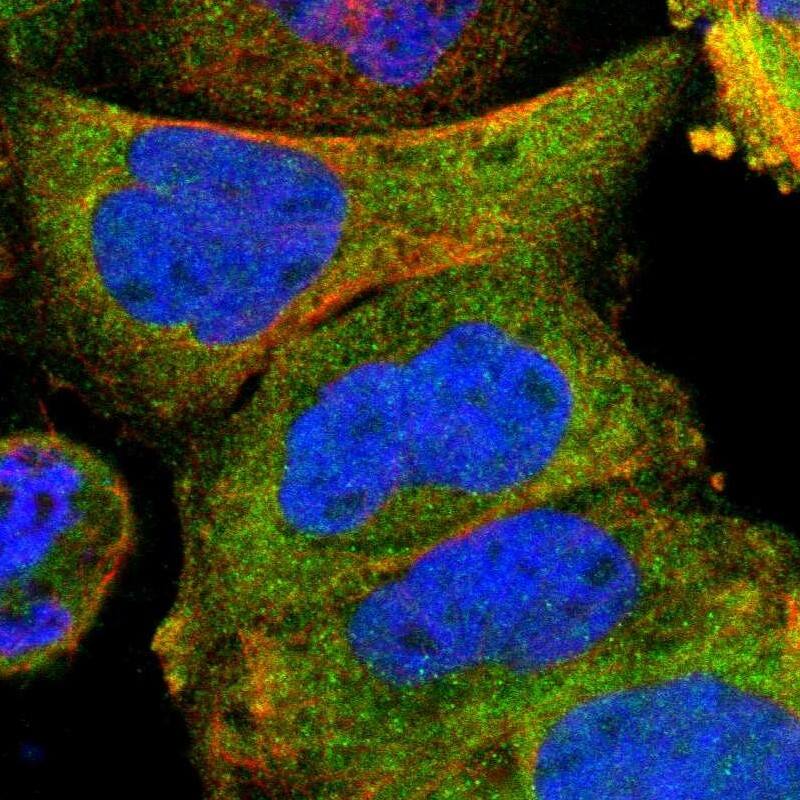 Adenylate Kinase 1 Antibody - BSA Free Immunocytochemistry/ Immunofluorescence: Adenylate Kinase 1 Antibody [NBP1-87401]