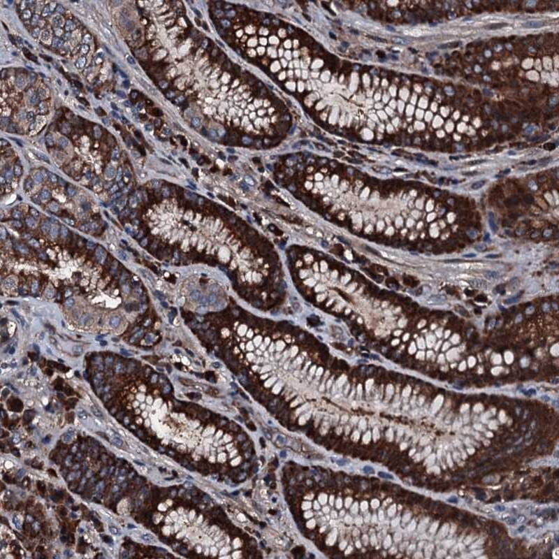 Alanyl tRNA synthetase Antibody - BSA Free Immunohistochemistry-Paraffin: Alanyl tRNA synthetase Antibody [NBP1-87414]