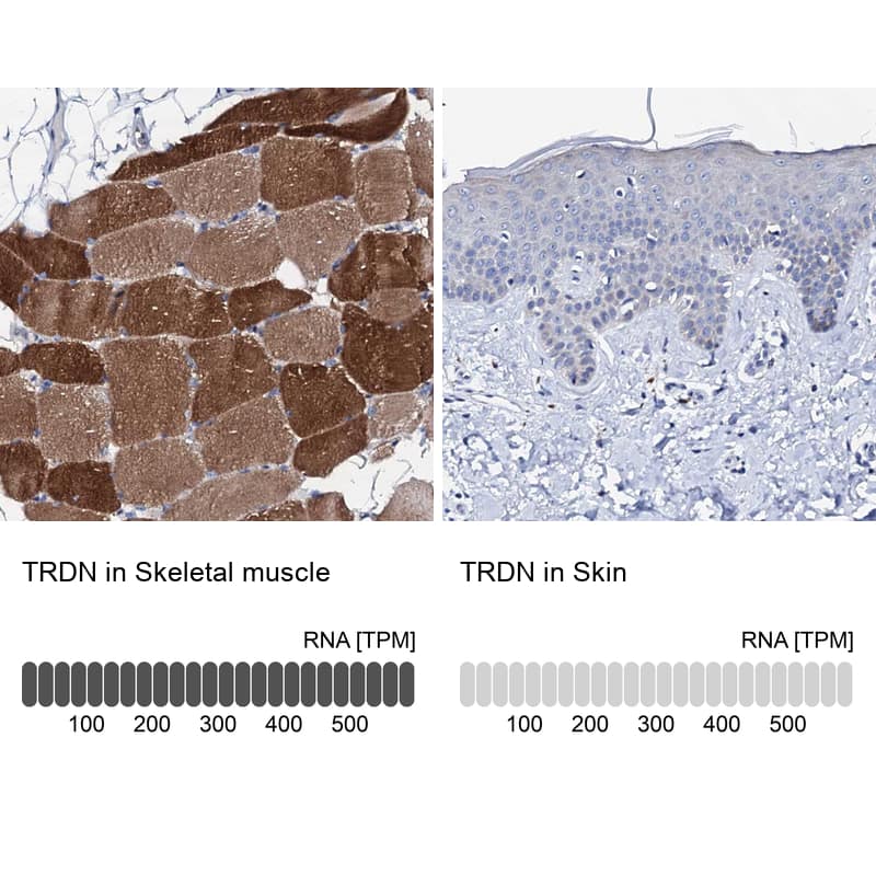 Triadin Antibody - BSA Free Immunohistochemistry-Paraffin: Triadin Antibody [NBP1-87417]